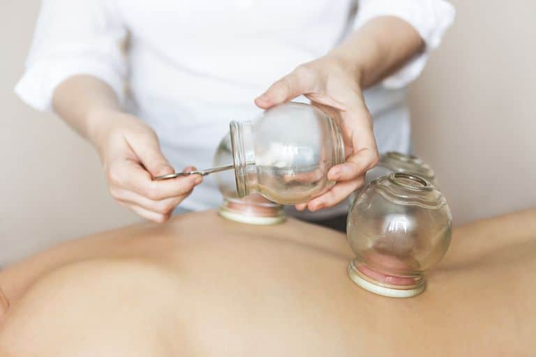 The Myths & Truths behind Myofascial Cupping Therapy 7